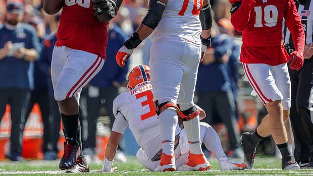 Wisconsin nose tackle Keeanu Benton celebrates a sack against Illinois.