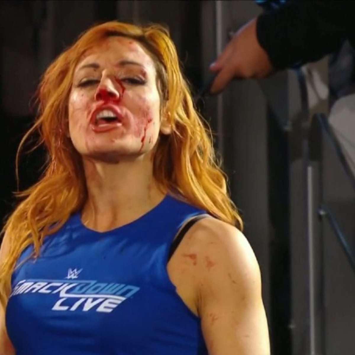 WWE: Becky Lynch, the 'anti Ronda Rousey,' gets her face split open - Foto  12 de 13