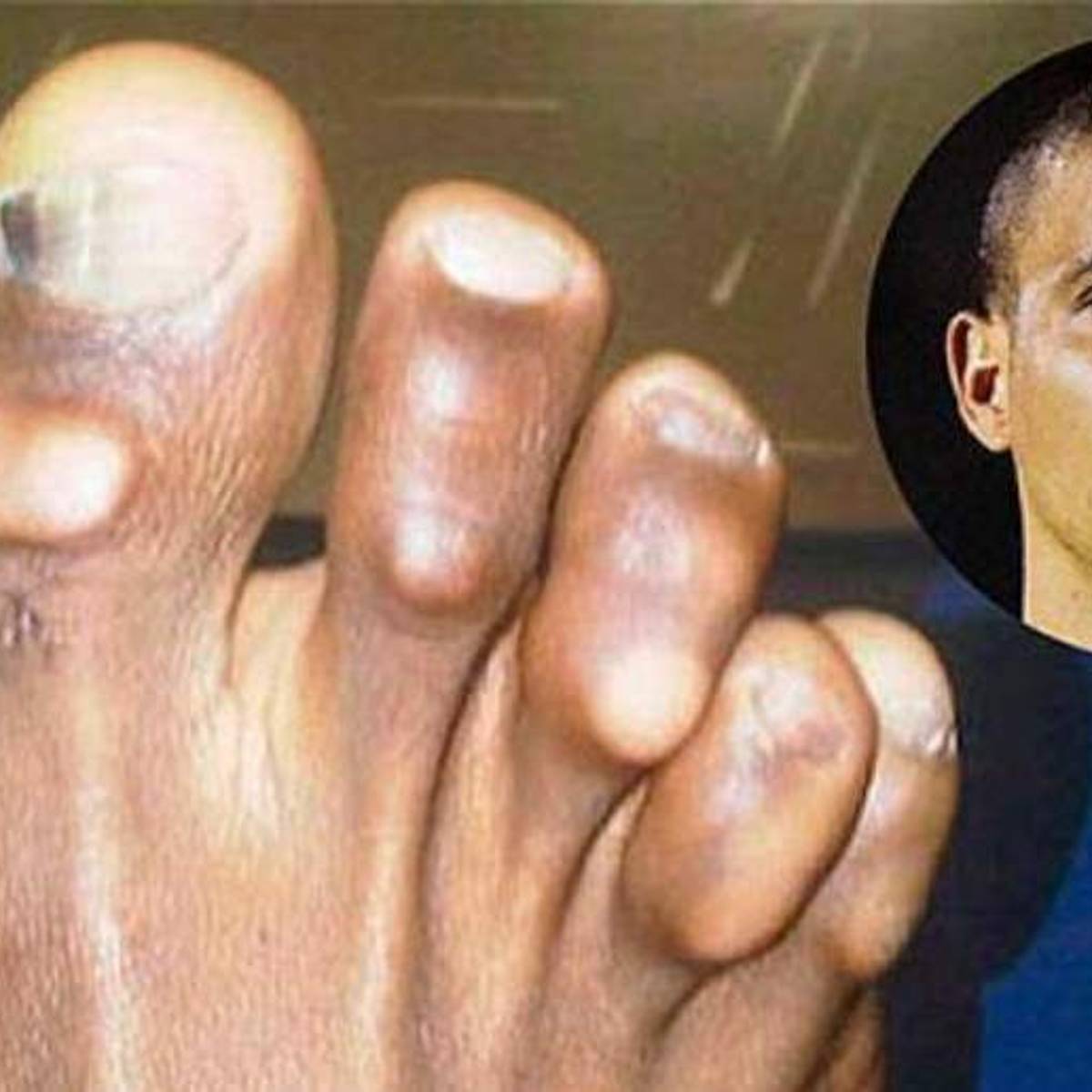 DE MIEDO | Los 7 futbolistas de élite mundial que tienen los pies más  horrendos - Sports Illustrated