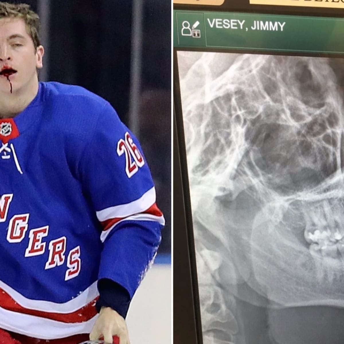 Jimmy Vesey Hockey Stats and Profile at