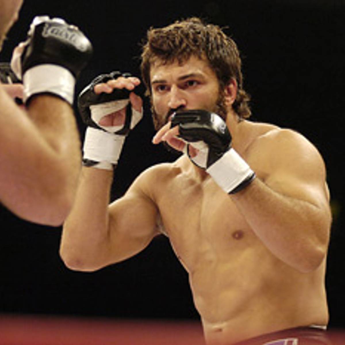 Andrei Arlovski Missing Teeth