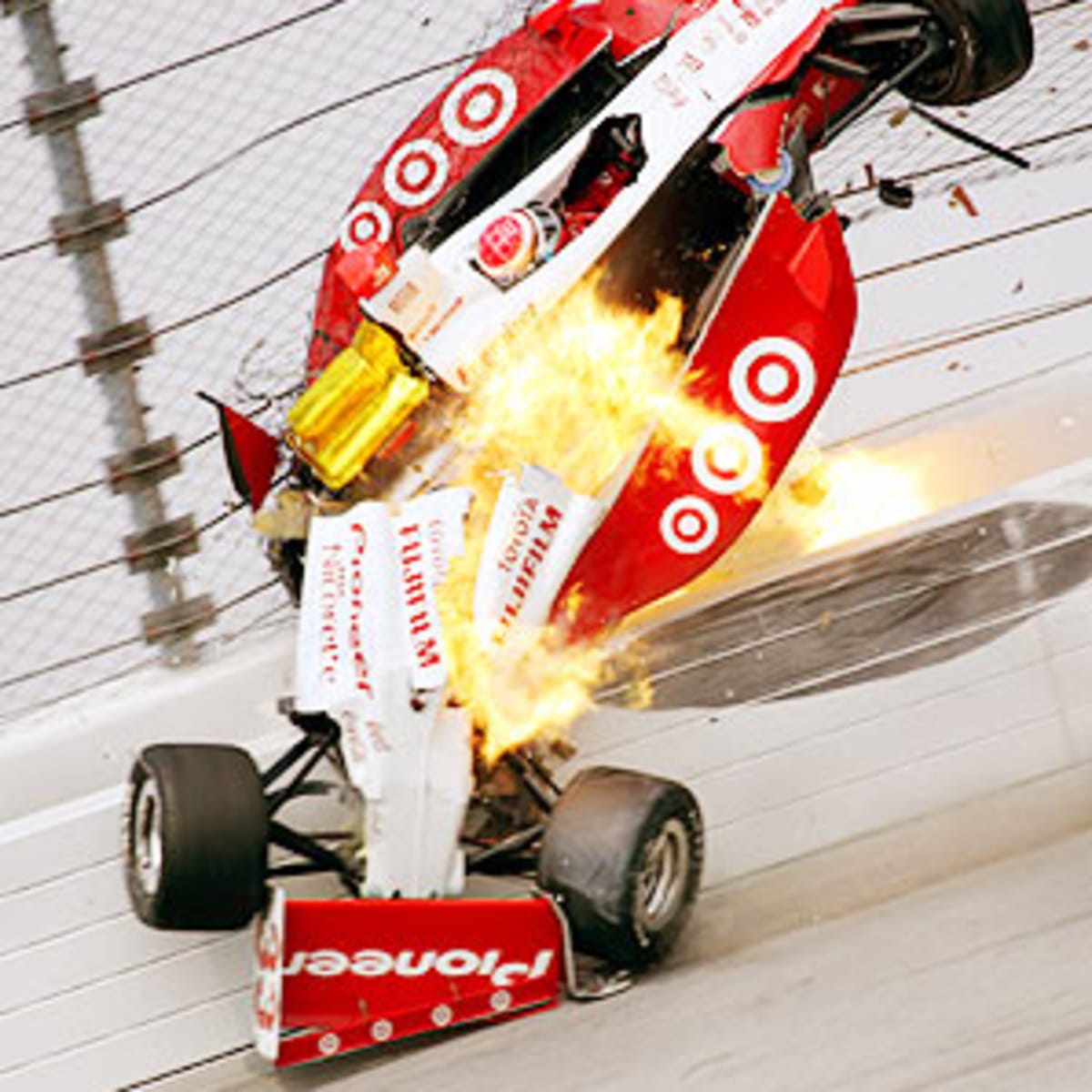 Basilar Skull Fracture Dale Earnhardt