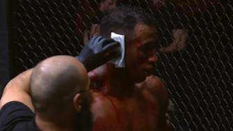 MMA VIDEO: Fighter's Ear Explodes In Horrific Injury at ACA 166
