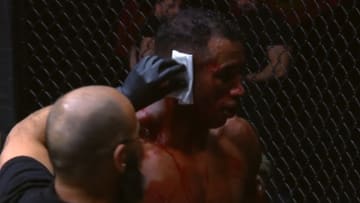 MMA VIDEO: Fighter's Ear Explodes In Horrific Injury at ACA 166