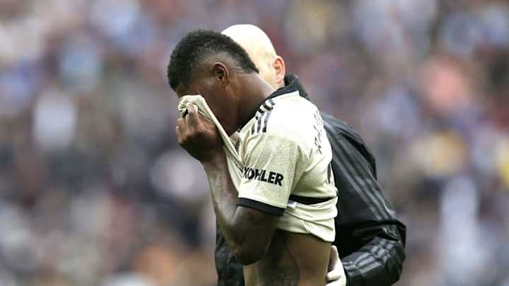 Solskjaer Indicates Rashford to Be Out 'for a Little While' for Man United