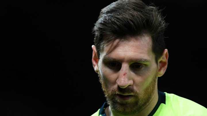 Messi se someterá a pruebas para determinar si sufre una fisura nasal