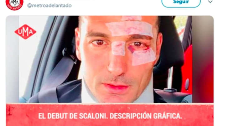 Los mejores memes de la derrota de Argentina frente a Colombia: Messi, Scaloni, Agüero y más