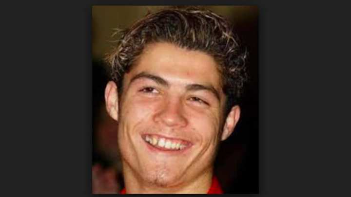 Las cirugías plásticas que se habría Cristiano Ronaldo a lo largo de su carrera