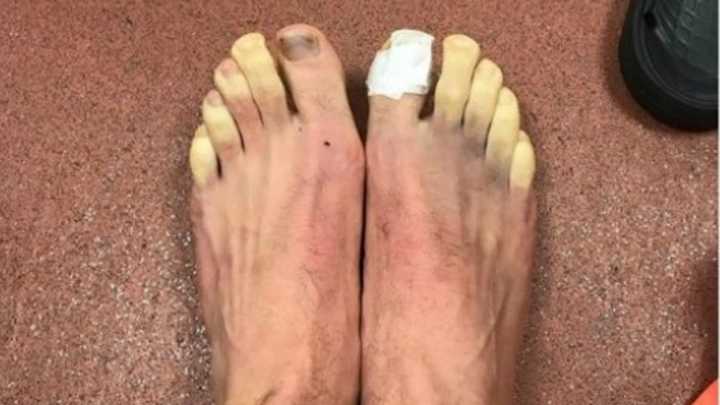 INSÓLITO | El futbolista de la Premier League que pidió ayuda para descongelar sus pies