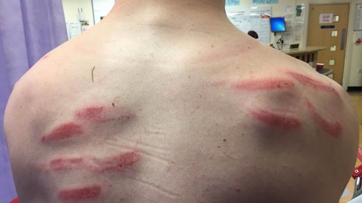 PHOTO: National League Star Gives Update on Horrid Injury After Being Rushed to Hospital