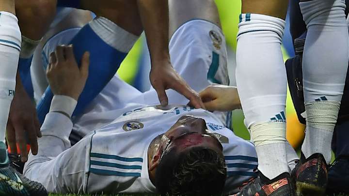 FOTOS | Así le ha quedado la cara a Cristiano tras la patada que le dio su rival