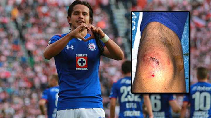 ¡QUÉ DOLOR! | Jerry Flores enseñó la terrible herida por la que recibió una tarjeta amarilla