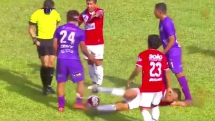 TERRIBLE | La impactante patada al cuello en pleno partido en el fútbol peruano TERRIBLE | La impactante patada al cuello en pleno partido en el fútbol peruano