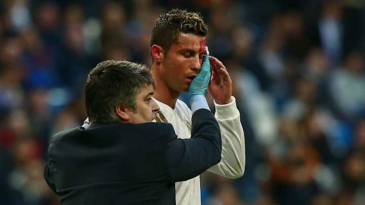 Real Madrid Talisman Cristiano Ronaldo to Miss Leganes Game Due to Swelling Under His Eye