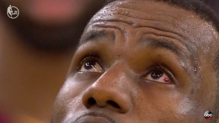Watch: LeBron James' Eye Bleeds in Game 1 After Getting Poked by Draymond Green Watch: LeBron James' Eye Bleeds in Game 1 After Getting Poked by Draymond Green