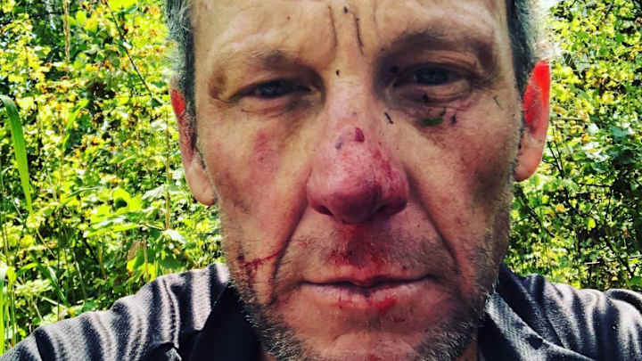 Lance Armstrong Heads to Hospital After Bloody Bike Crash on Colorado Trail