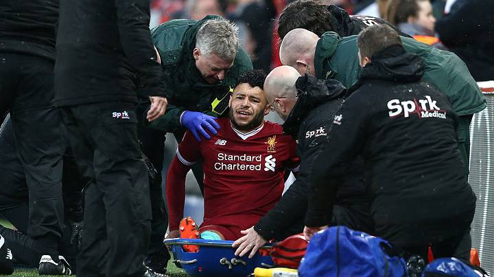 Oxlade-Chamberlain Suffers 'Really Bad' Injury in Liverpool's UCL Win Oxlade-Chamberlain Suffers 'Really Bad' Injury in Liverpool's UCL Win