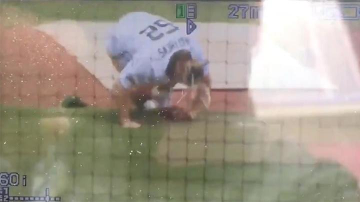 Clay Matthews Suffers Broken Nose at Charity Softball Game Clay Matthews Suffers Broken Nose at Charity Softball Game