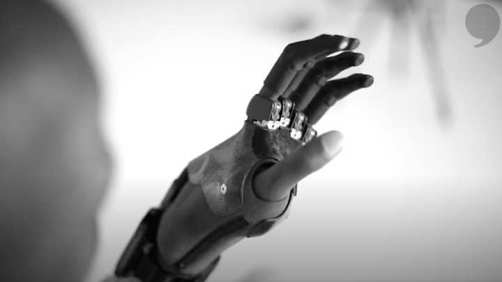 Ex-NFL WR Mohamed Massaquoi Had Most of His Left Hand Amputated After ATV Accident Ex-NFL WR Mohamed Massaquoi Had Most of His Left Hand Amputated After ATV Accident