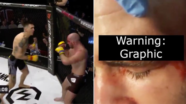 MMA Fighter Left With Gaping Chasm of a Head Wound