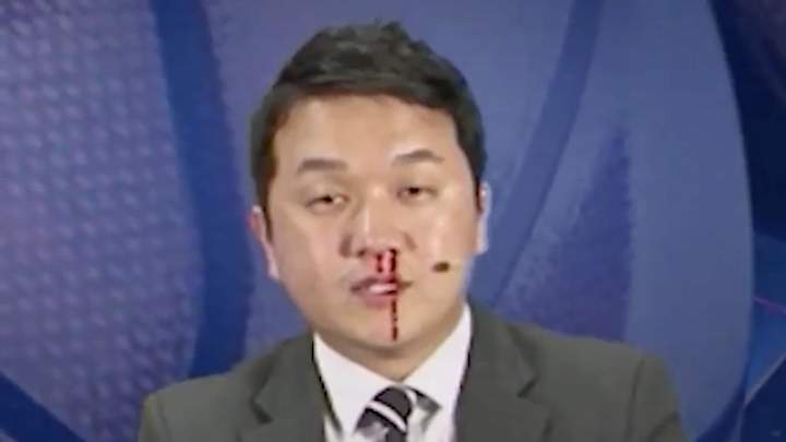Watch: Korean Sportscaster Keeps His Cool While Blood Pours Down His Face