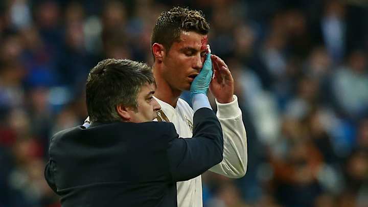 Zidane Defends Cristiano Ronaldo After Player Slated for Using Phone Camera to Check Head Wound