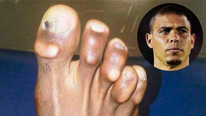 DE MIEDO | Los 7 futbolistas de élite mundial que tienen los pies más horrendos
