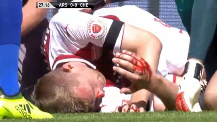 WATCH: Per Mertesacker Leaves After Gary Cahill's Elbow Strikes Face