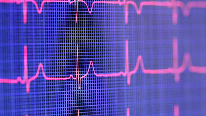 What Is Heart Rate Variability–and Do You Need to Know Yours? What Is Heart Rate Variability–and Do You Need to Know Yours?