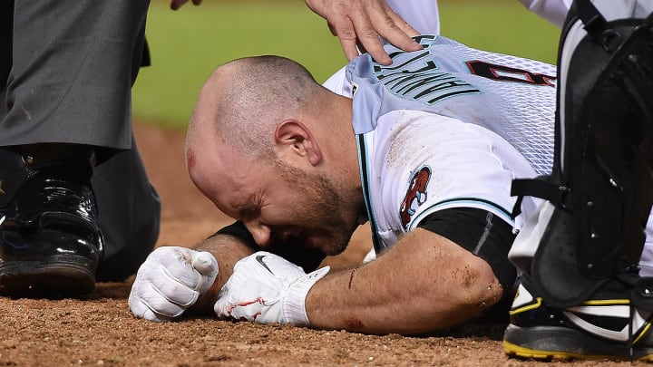 Diamondbacks' Chris Iannetta has stitches in lip, fractured teeth, nose