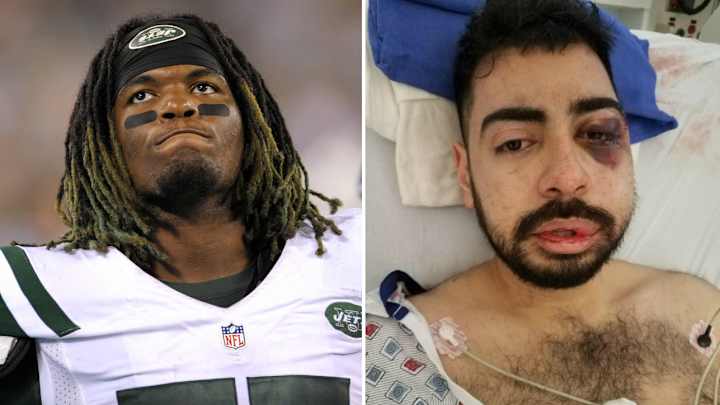 Jets LB accused of leaving man with multiple facial fractures in nightclub ‘attack’ Jets LB accused of leaving man with multiple facial fractures in nightclub ‘attack’