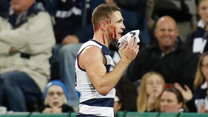 Nasty collision leaves Aussie rules football player a bloody mess