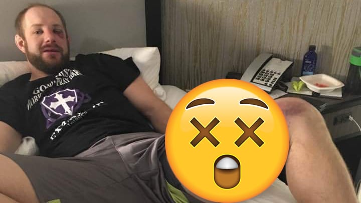 MMA fighter shares photo of gruesome bruise after taking kick to thigh