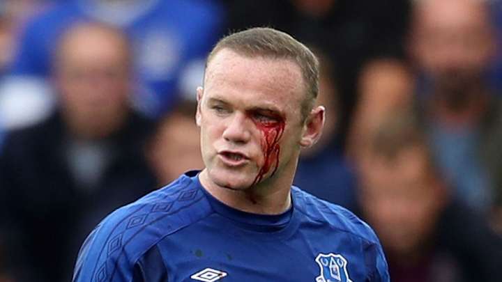 PHOTO: Wayne Rooney Left Absolutely Bloodied After Challenge From Simon Francis During Everton Win