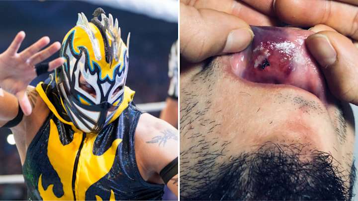 Kalisto Needs Stitches After Fan Throws Water Bottle at Him