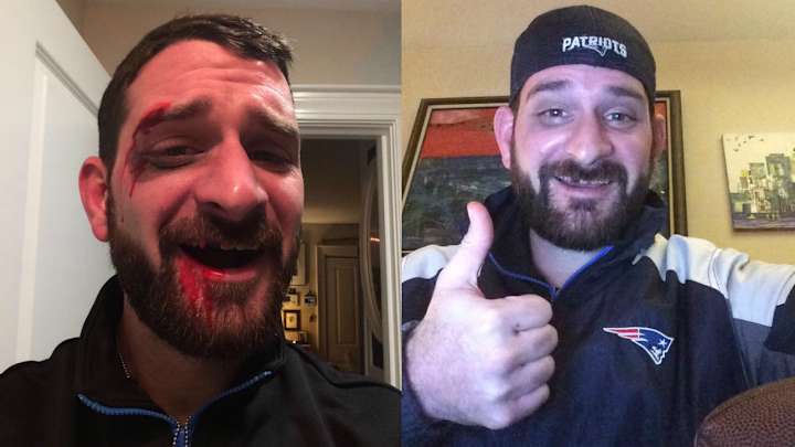 Patriots fan admits he faked story about losing tooth on Tom Brady scavenger hunt