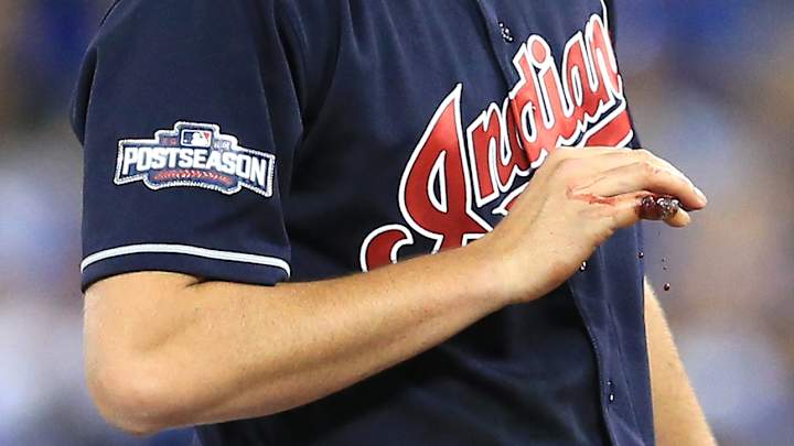 Trevor Bauer asked to have his bleeding finger Crying Jordan'd, so his teammate did the honors Trevor Bauer asked to have his bleeding finger Crying Jordan'd, so his teammate did the honors