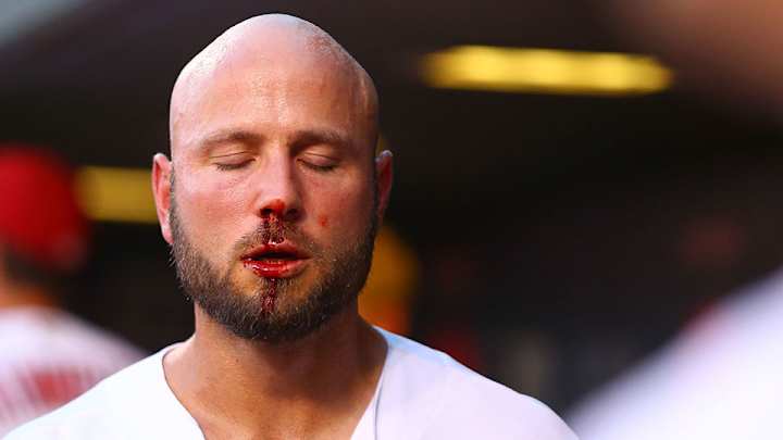 Matt Holliday leaves game after being hit in face by pitch
