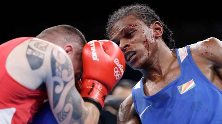 Blood and guts: Olympic boxers dealing with facial cuts Blood and guts: Olympic boxers dealing with facial cuts