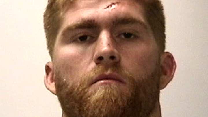 Prosecutors charge 49er Miller in attack on 2 men