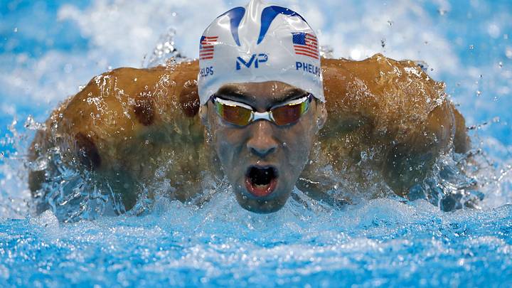 Phelps is touting the benefit of cupping - but does it work? Phelps is touting the benefit of cupping - but does it work?