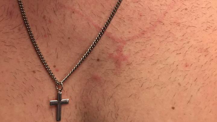 Noah Syndergaard leaves quite the impression on his catcher