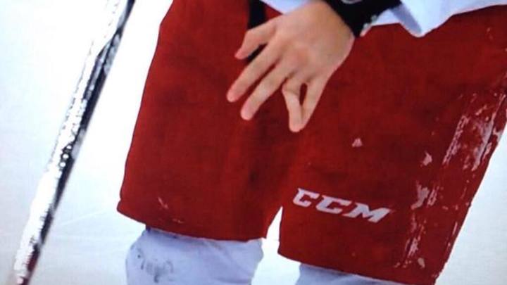 Hurricanes' Michal Jordan dislocated his finger but didn't miss a shift Hurricanes' Michal Jordan dislocated his finger but didn't miss a shift