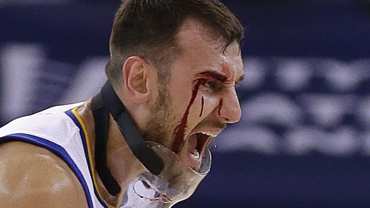 Warriors C Bogut sustains concussion in season-opening win