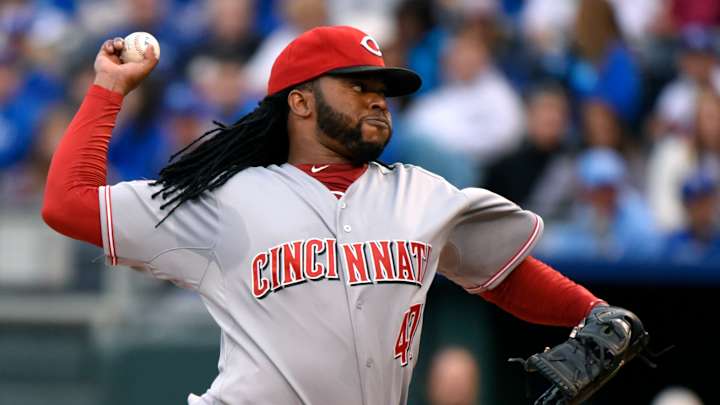 MRI finds inflammation in Cueto's elbow but no major problem