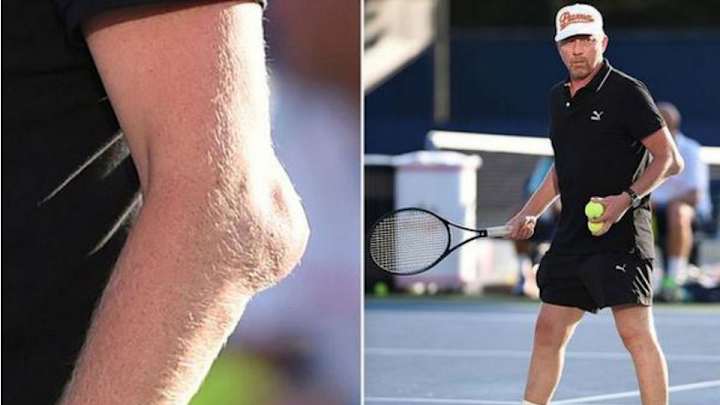 Boris Becker has an extreme case of tennis elbow at the U.S Open Boris Becker has an extreme case of tennis elbow at the U.S Open
