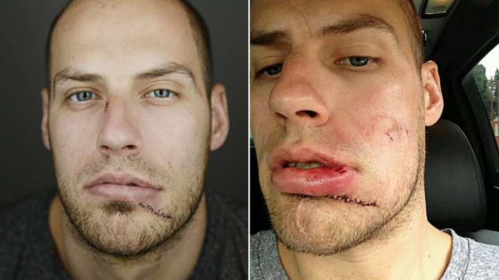 NHL's Faces Of Battle NHL's Faces Of Battle