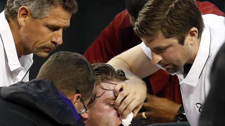 Arizona's Bradley to DL after getting struck by line drive Arizona's Bradley to DL after getting struck by line drive