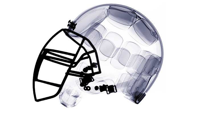 How will NFL improve concussion problem over the next 50 years? How will NFL improve concussion problem over the next 50 years?