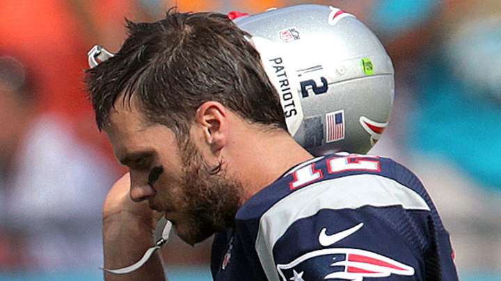 Tom Brady’s Bad Day